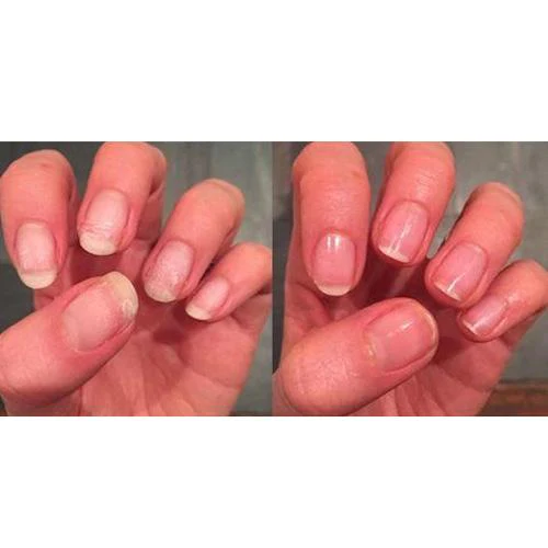 Pink Armour Nail Gel - Image 3